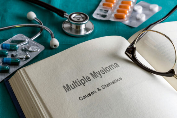 Mnohočetný myelom – jak pomoci včasné diagnostice